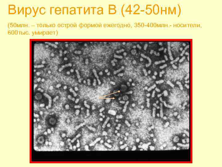 Вирус гепатита В (42 -50 нм) (50 млн. – только острой формой ежегодно, 350