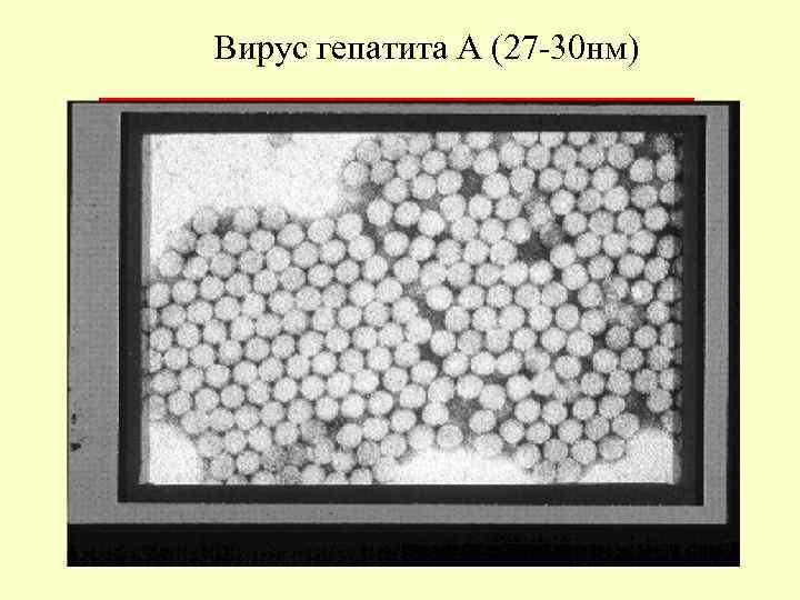 Вирус гепатита А (27 -30 нм) 