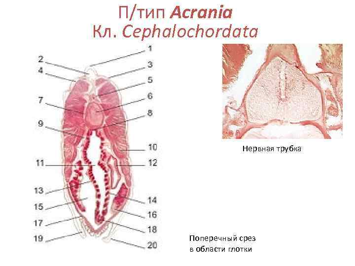   П/тип Acrania Кл. Cephalochordata      Нервная трубка 