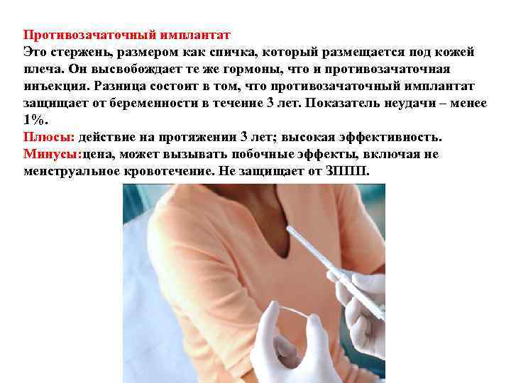 Противозачаточный имплантат Это стержень, размером как спичка, который размещается под кожей плеча. Он Противозачаточный имплантат Это стержень, размером как спичка, который размещается под кожей плеча. Он