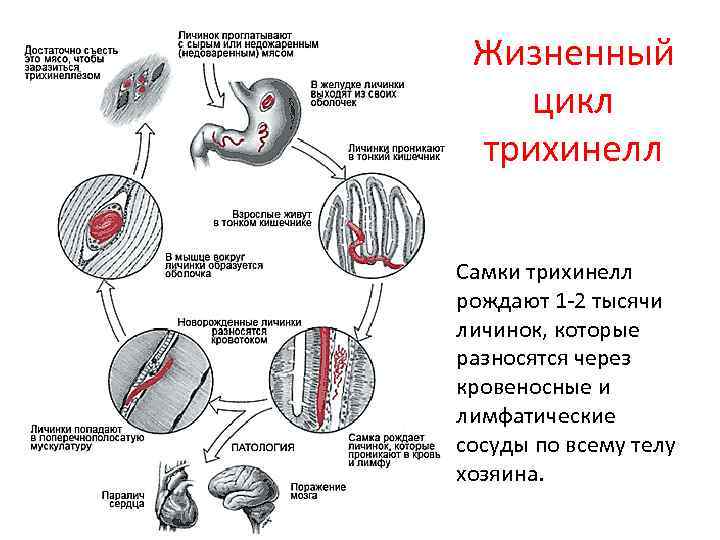 Развитие трихинеллы    Жизненный      цикл  