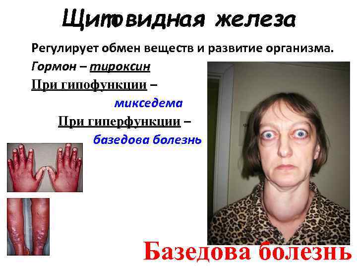   Щитовидная железа Регулирует обмен веществ и развитие организма. Гормон – тироксин При