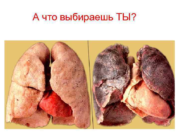 А что выбираешь ТЫ? 