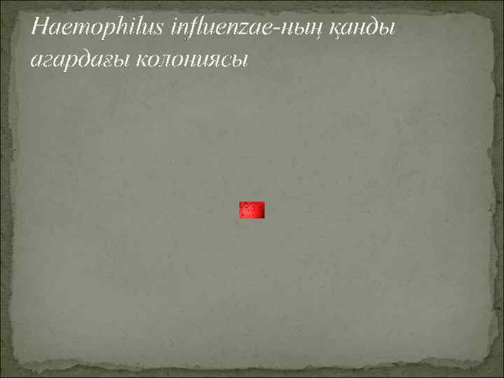 Haemophilus influenzae-ның қанды агардағы колониясы 