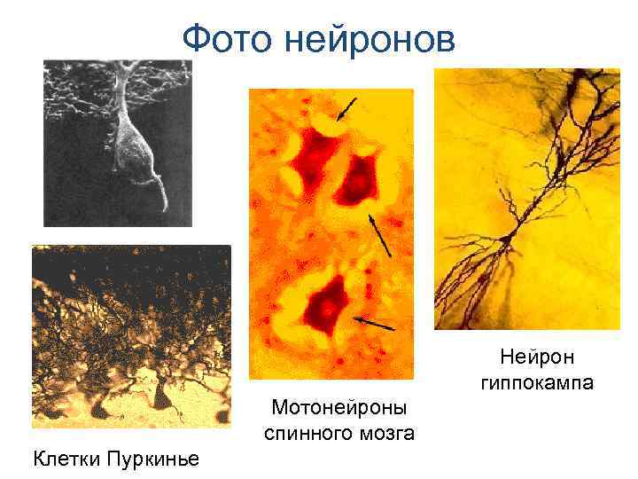 Фото нейронов Нейрон Фото нейронов Нейрон