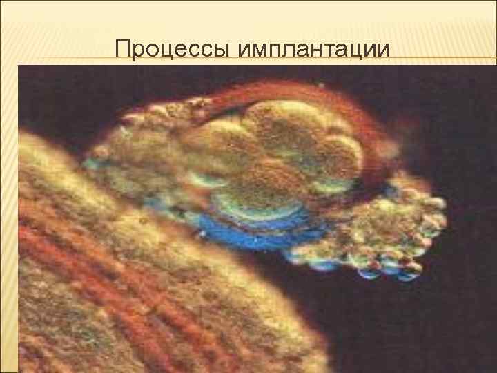 Процессы имплантации Процессы имплантации