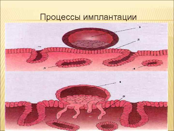 Процессы имплантации Процессы имплантации
