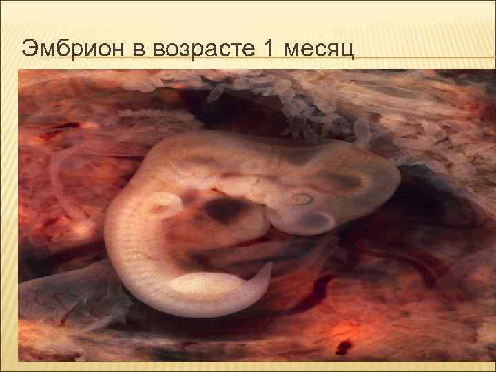 Эмбрион в возрасте 1 месяц Эмбрион в возрасте 1 месяц