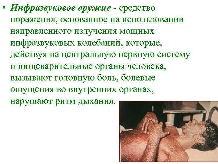  • Инфразвуковое оружие - средство  поражения, основанное на использовании  направленного излучения