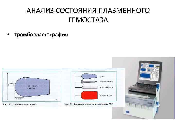 Исследование гемостаза