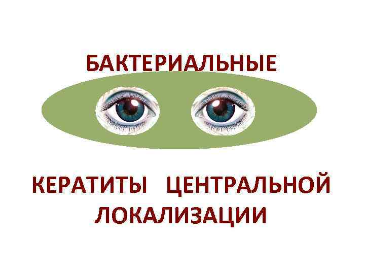   БАКТЕРИАЛЬНЫЕ  КЕРАТИТЫ ЦЕНТРАЛЬНОЙ ЛОКАЛИЗАЦИИ 