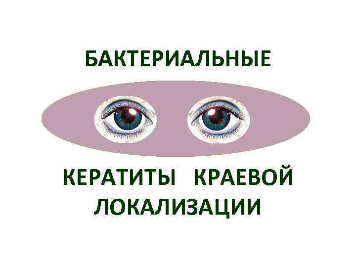  БАКТЕРИАЛЬНЫЕ  КЕРАТИТЫ КРАЕВОЙ  ЛОКАЛИЗАЦИИ 