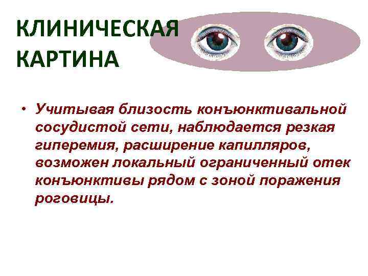 КЛИНИЧЕСКАЯ КАРТИНА • Учитывая близость конъюнктивальной  сосудистой сети, наблюдается резкая  гиперемия, расширение