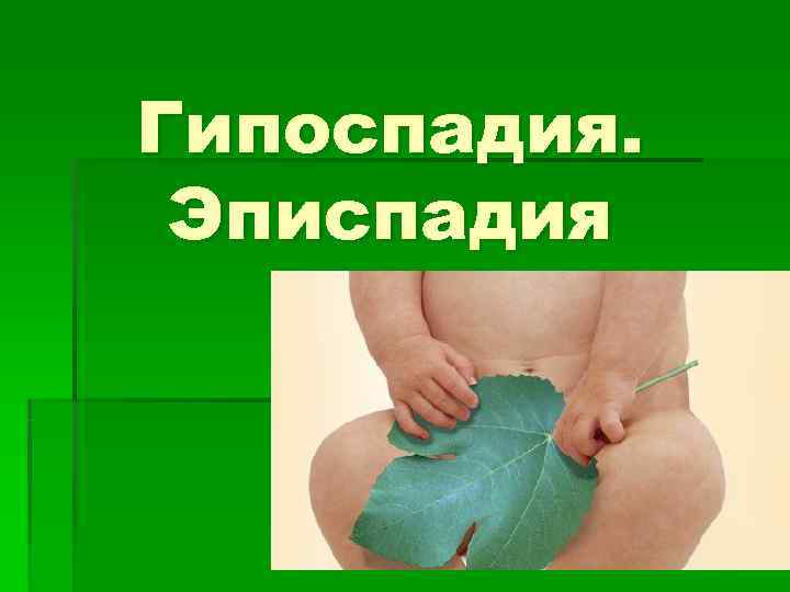 Гипоспадия.  Эписпадия 