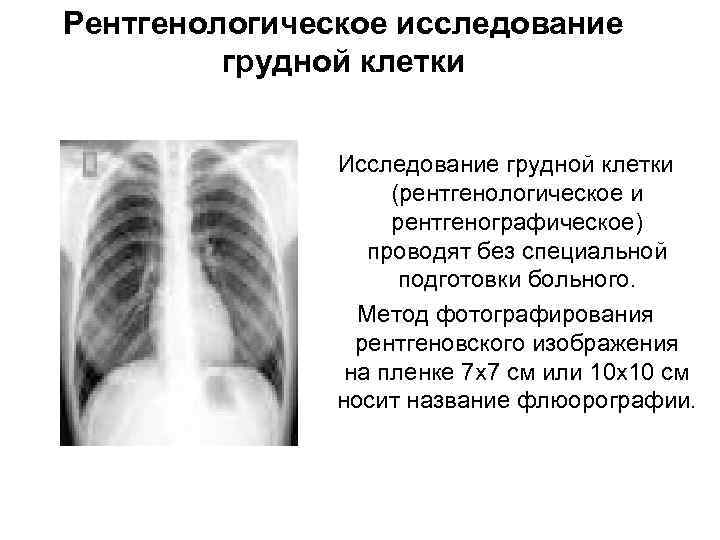 Рентгенологическое обследование грудной клетки