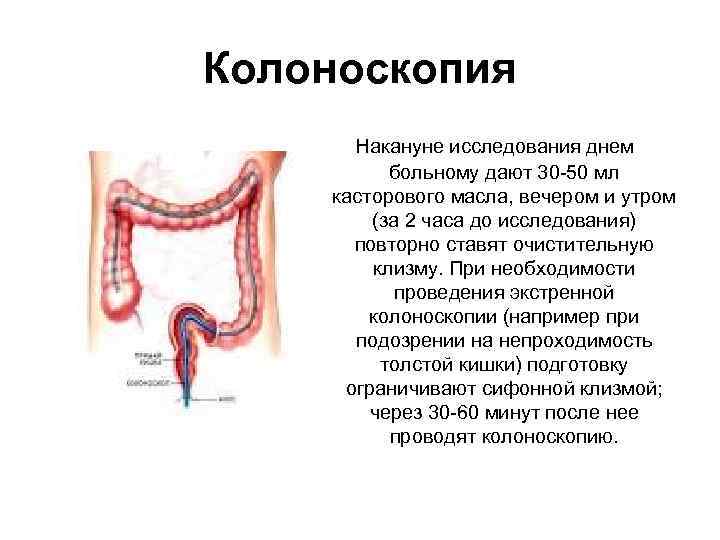 Колоноскопия какой. Колоноскопия накануне. Колоноскопия презентация. Колоноскопия накануне исследования. Колоноскопия схема проведения.