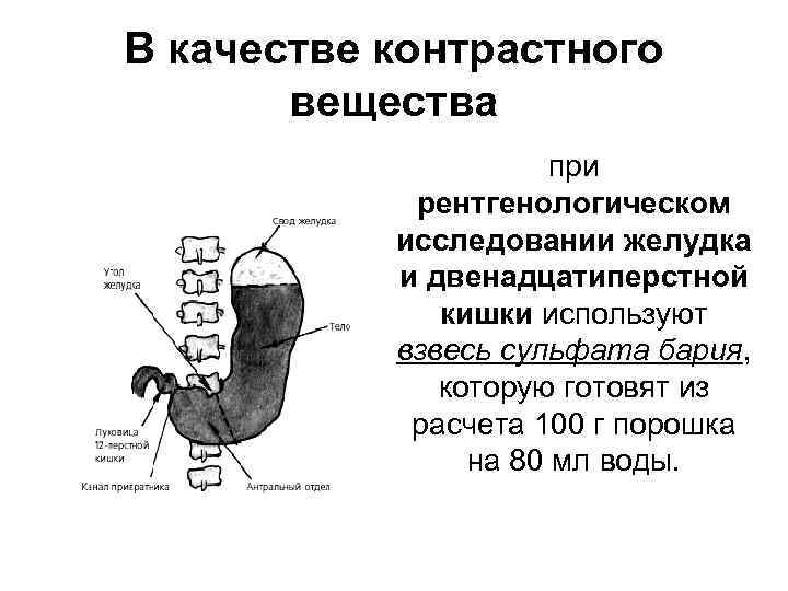 Подготовка желудка к. Рентген желудка с контрастным веществом. Подготовка больного к рентгенологическому исследованию ЖКТ. Подготовка к рентгеноскопии желудка и двенадцатиперстной.