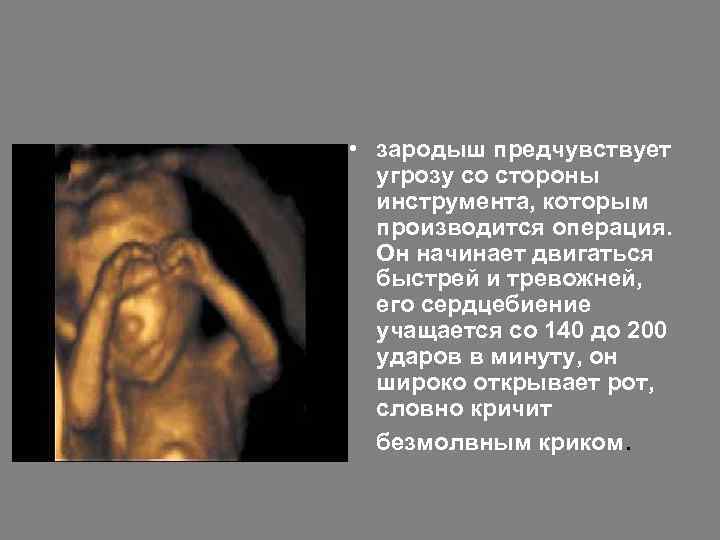  • зародыш предчувствует  угрозу со стороны  инструмента, которым  производится операция.