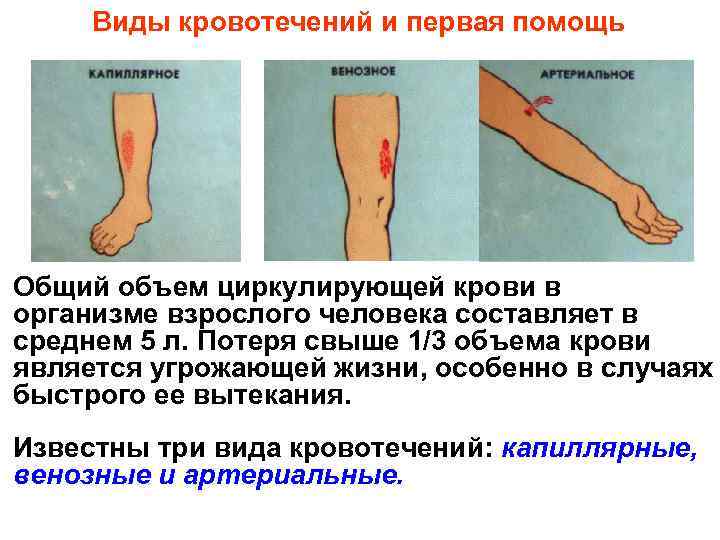  Виды кровотечений и первая помощь Общий объем циркулирующей крови в организме взрослого человека