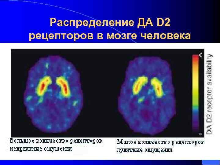  Распределение ДА D 2  рецепторов в мозге человека l По результатам ПЭТ