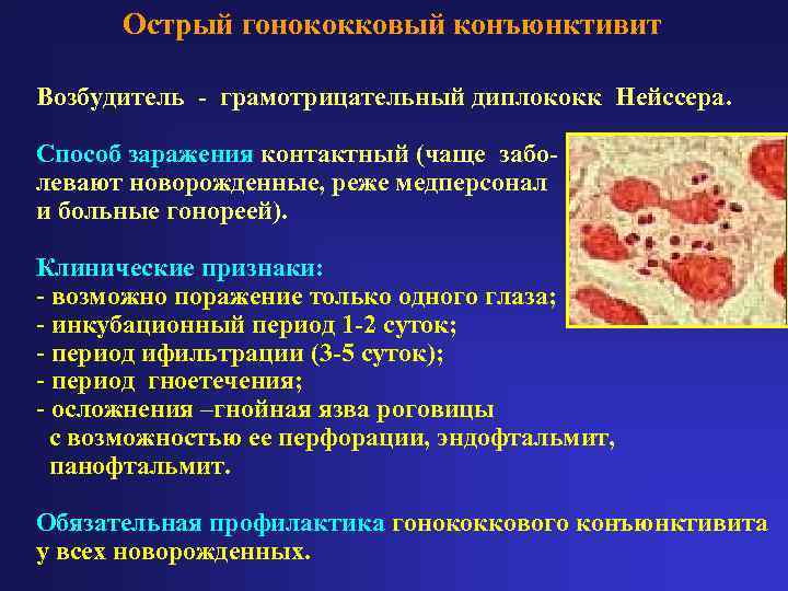  Острый гонококковый конъюнктивит Возбудитель - грамотрицательный диплококк Нейссера.  Способ заражения контактный (чаще