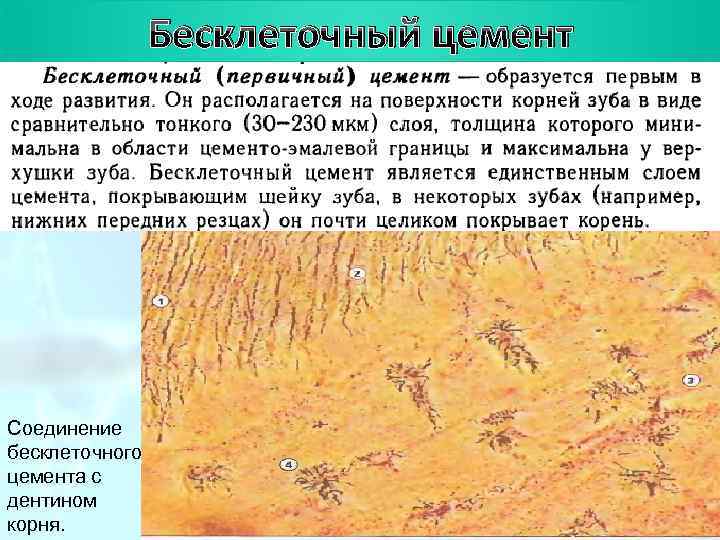     План цемент   Бесклеточный Соединение бесклеточного цемента с дентином