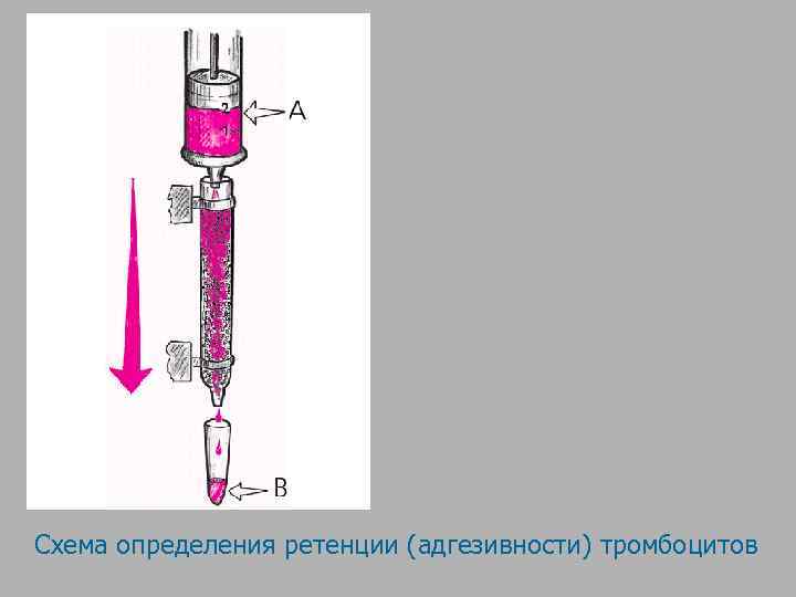Схема определения ретенции (адгезивности) тромбоцитов 