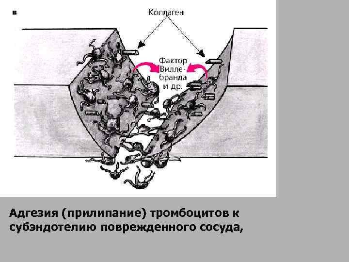 Адгезия (прилипание) тромбоцитов к субэндотелию поврежденного сосуда, 