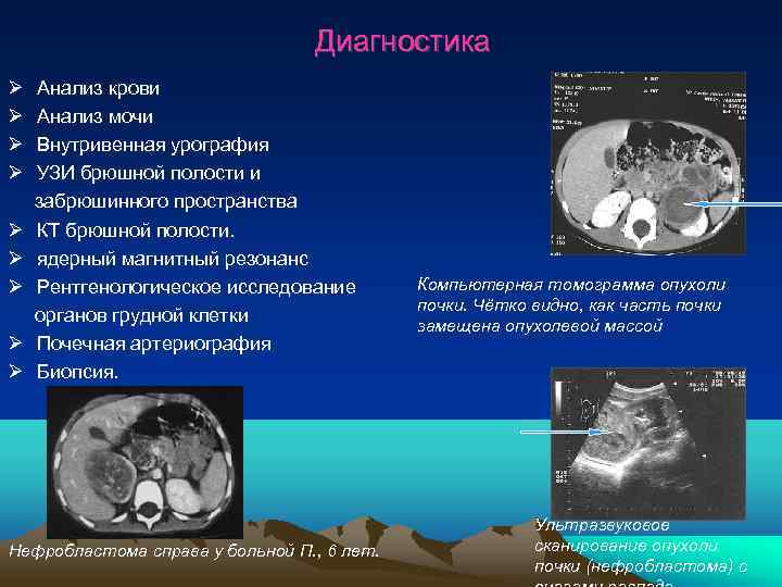        Диагностика  Анализ крови  Анализ мочи