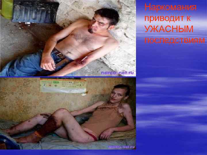 Наркомания приводит к УЖАСНЫМ последствиям 