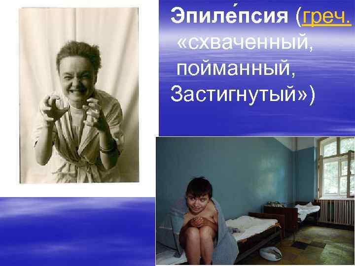 Эпиле псия (греч.  «схваченный, пойманный, Застигнутый» ) 