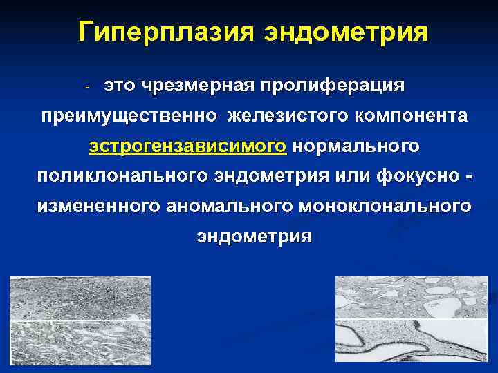 Гиперплазия эндометрия - это чрезмерная пролиферация преимущественно железистого компонента эстрогензависимого нормального Гиперплазия эндометрия - это чрезмерная пролиферация преимущественно железистого компонента эстрогензависимого нормального