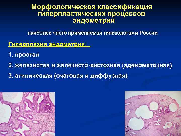 Морфологическая классификация гиперпластических процессов эндометрия наиболее часто Морфологическая классификация гиперпластических процессов эндометрия наиболее часто