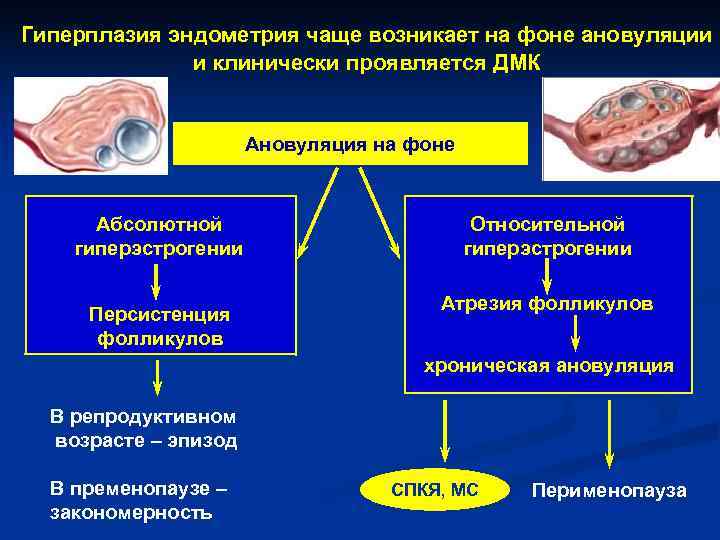Гиперплазия эндометрия чаще возникает на фоне ановуляции и клинически проявляется ДМК Гиперплазия эндометрия чаще возникает на фоне ановуляции и клинически проявляется ДМК