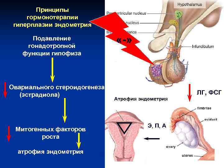 Принципы гормонотерапии гиперплазии эндометрия Подавление гонадотропной Принципы гормонотерапии гиперплазии эндометрия Подавление гонадотропной
