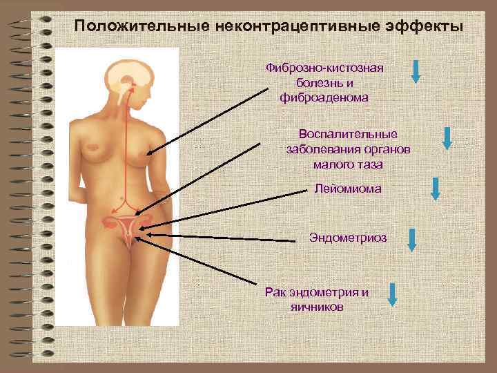Положительные неконтрацептивные эффекты     Фиброзно-кистозная    болезнь и 