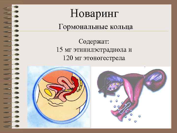   Новаринг Гормональные кольца   Содержат: 15 мг этинилэстрадиола и  120