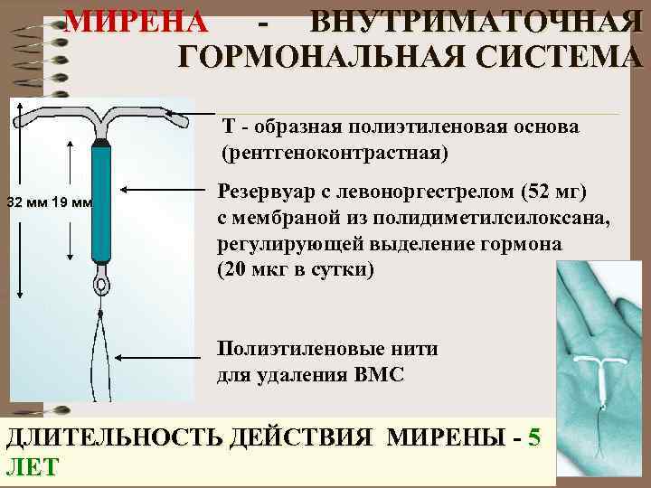 Мирена при миоме и эндометриозе