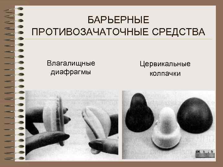   БАРЬЕРНЫЕ ПРОТИВОЗАЧАТОЧНЫЕ СРЕДСТВА Влагалищные  Цервикальные  диафрагмы колпачки 
