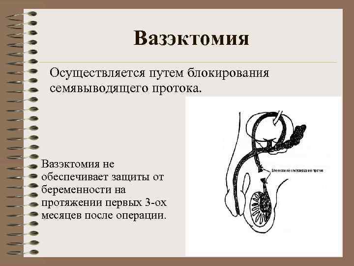     Вазэктомия Осуществляется путем блокирования семявыводящего протока. Вазэктомия не обеспечивает защиты