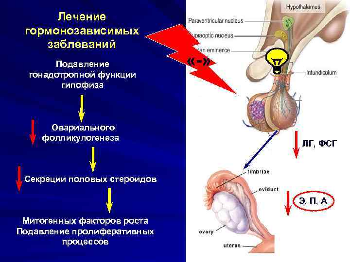  Лечение гормонозависимых заблеваний  Подавление   «-»  гонадотропной функции  