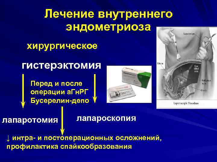    Лечение внутреннего   эндометриоза хирургическое гистерэктомия  Перед и после