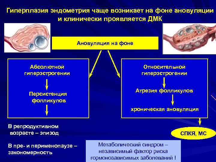 Гиперплазия эндометрия чаще возникает на фоне ановуляции    и клинически проявляется ДМК