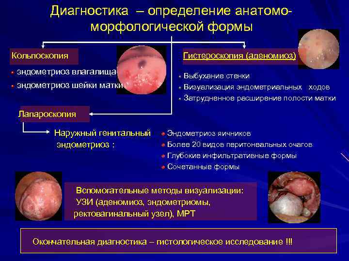 Диагностика – определение анатомо- морфологической формы Кольпоскопия Диагностика – определение анатомо- морфологической формы Кольпоскопия