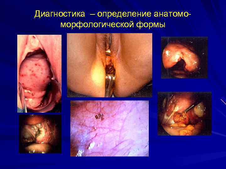Диагностика – определение анатомо- морфологической формы Диагностика – определение анатомо- морфологической формы