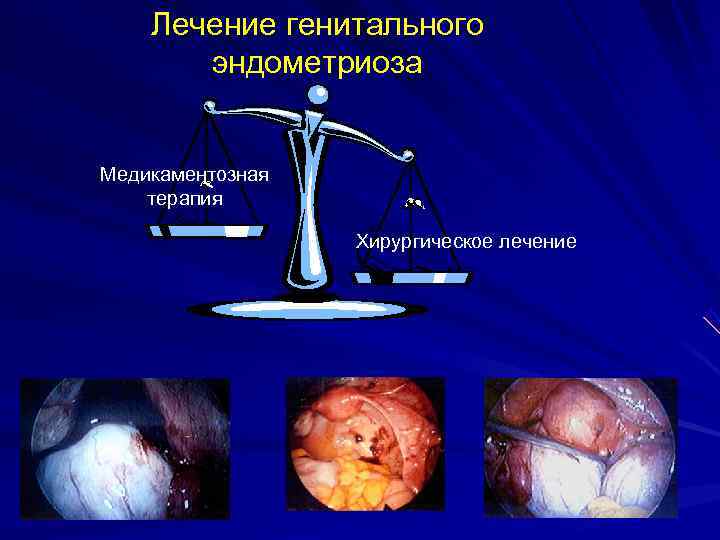 Лечение генитального эндометриоза Медикаментозная терапия Лечение генитального эндометриоза Медикаментозная терапия