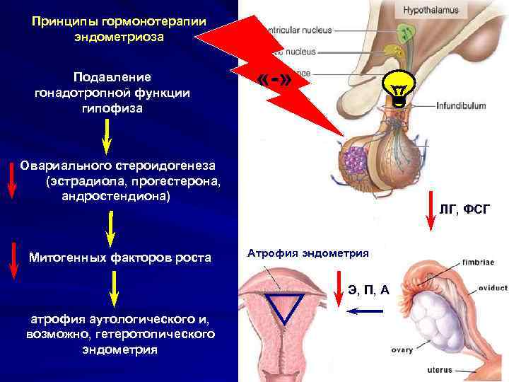 Принципы гормонотерапии эндометриоза Подавление гонадотропной функции Принципы гормонотерапии эндометриоза Подавление гонадотропной функции