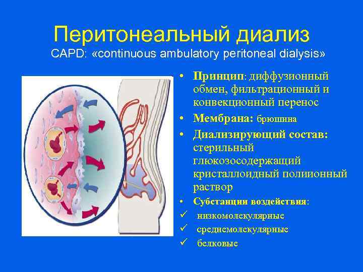 Перитонеальный диализ CAPD: «continuous ambulatory peritoneal dialysis» • Принцип: диффузионный обмен, фильтрационный и конвекционный