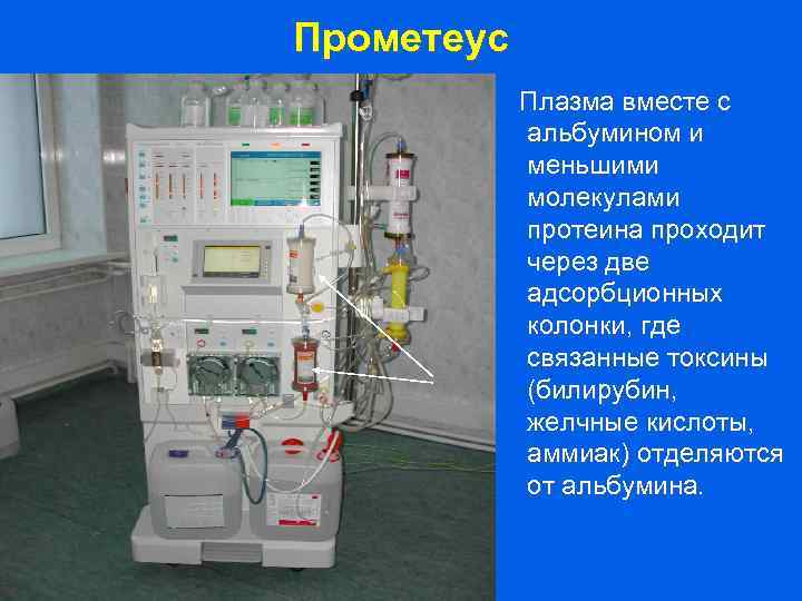 Прометеус Плазма вместе с альбумином и меньшими молекулами протеина проходит через две адсорбционных колонки,