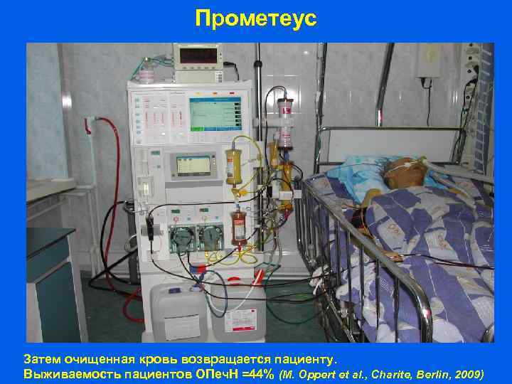 Прометеус Затем очищенная кровь возвращается пациенту. Выживаемость пациентов ОПеч. Н =44% (M. Oppert et